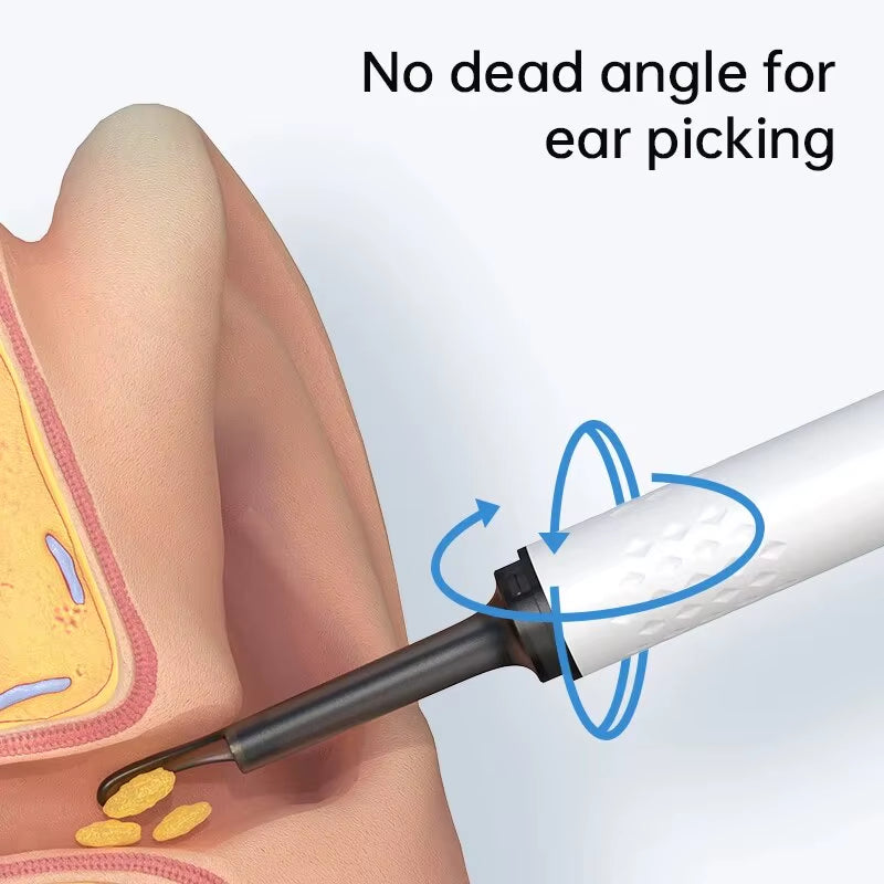 ClearView WiFi Ear Camera – HD Visual Ear Cleaner with LED Lights & Mini Earpick
